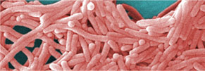Legionella w klimatyzacji